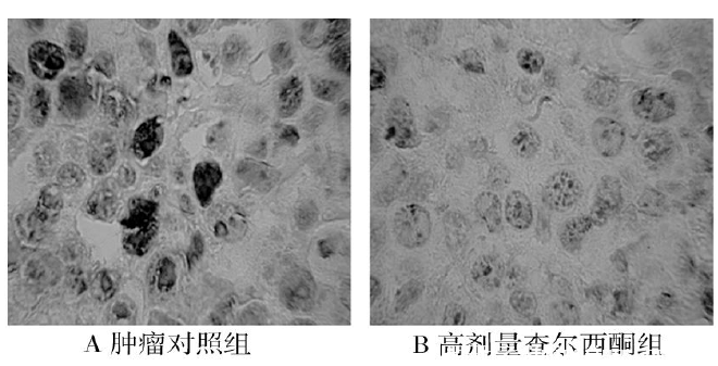 圖2　腫瘤對照組與高劑量組PCNA蛋白表達(DAB× 400)