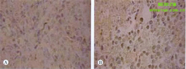 明日葉查爾酮對小鼠肝癌細胞Caspase-3和Bax蛋白表達的影響