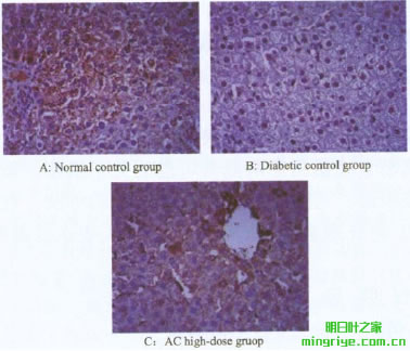 圖2 肝細胞 Ins R 蛋白的表達水平