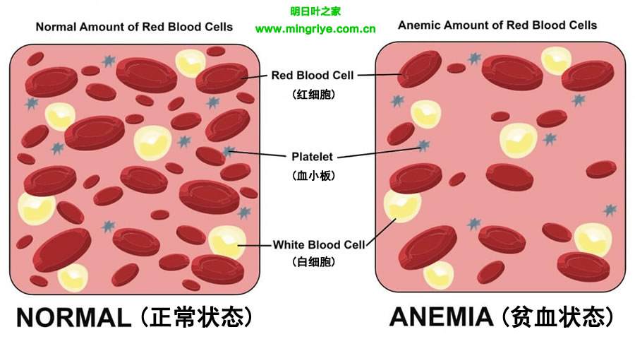 貧血紅細胞與正常紅細胞數量對比